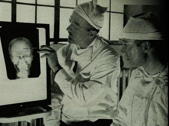 8 Chilling Facts About Lobotomy (7 Photos)