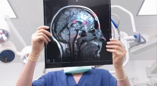 What will an MRI of the brain show in multiple sclerosis, diagnostic features