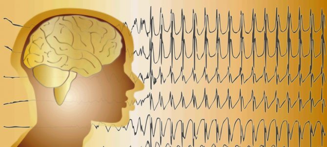 What is an electroencephalogram