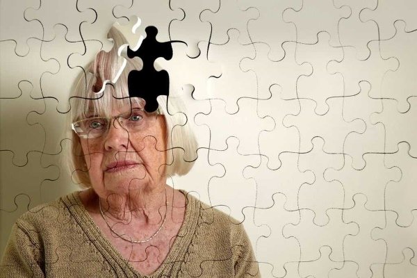 Dementia after stroke ⋆ Heart Treatment