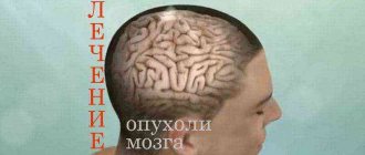 где делать операцию на головном мозге
