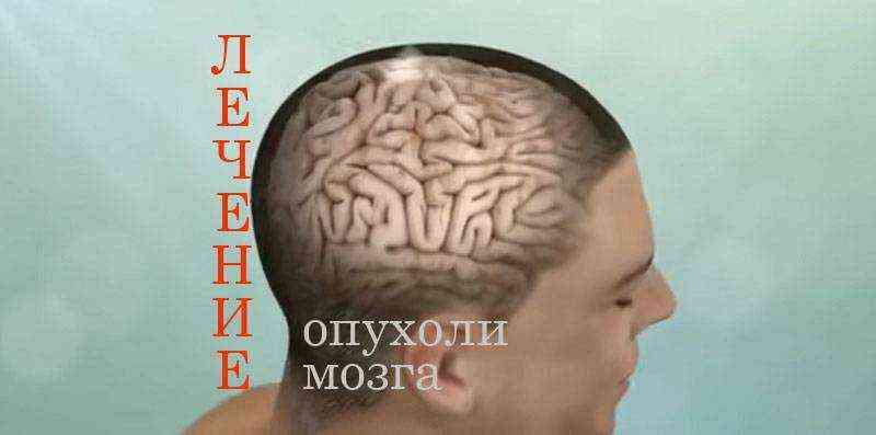 где делать операцию на головном мозге