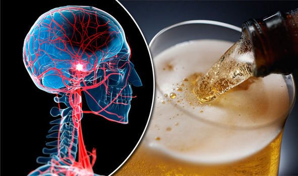 Инсульт и алкоголь: совместимость, последствия употребления спиртного, советы медиков