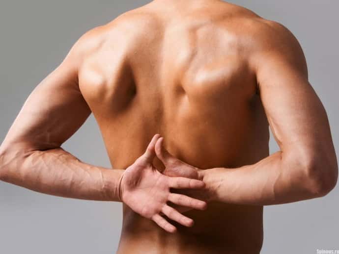 Как лечится невралгия спины