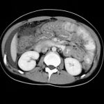 CT scan of internal organs