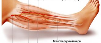 Treatment of neuropathy of the peroneal nerve with folk remedies of exercise therapy when affected by the disease