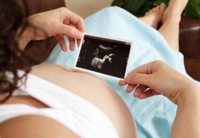 Can pregnant women drink afobazole?