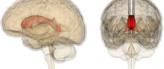 мозолистое тело мозга