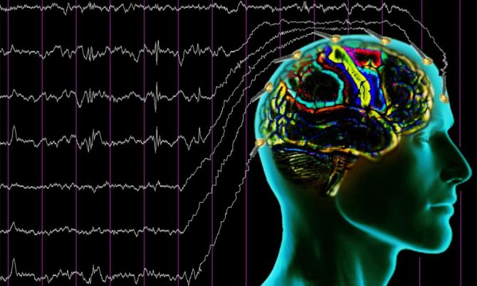 EEG shows moderate diffuse changes in bioelectrical activity