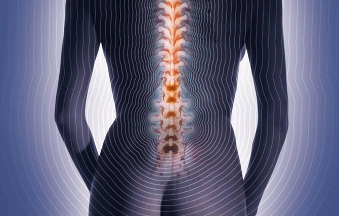 Невралгия спины - 10 симптомов и правильное лечение (таблетки, уколы, мази).