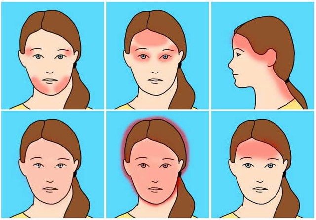 What causes migraine, how long does it last, difference from headache