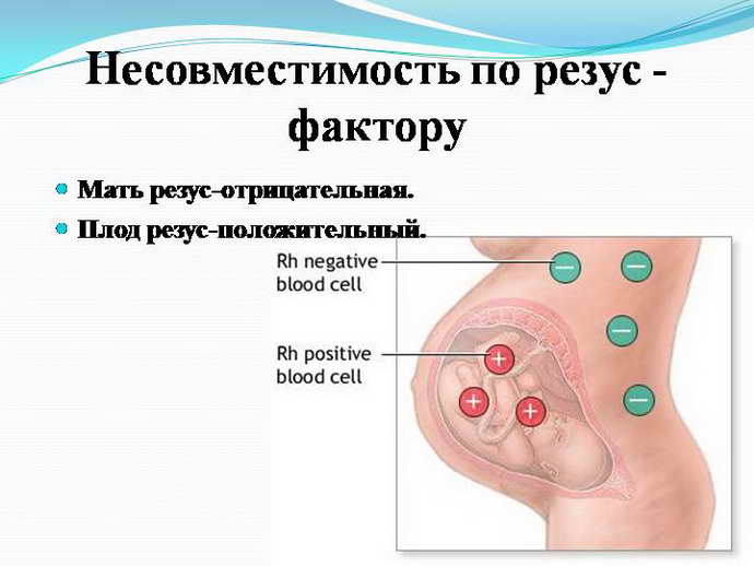 posthypoxic encephalopathy causes