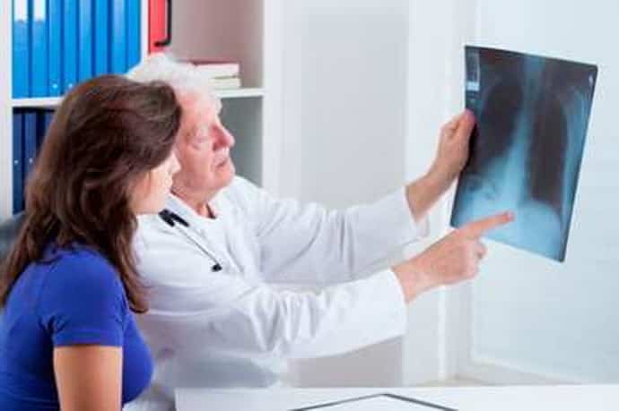 Рентген при невралгии спины