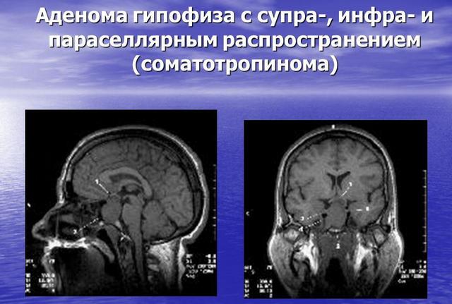 Снимки мозга