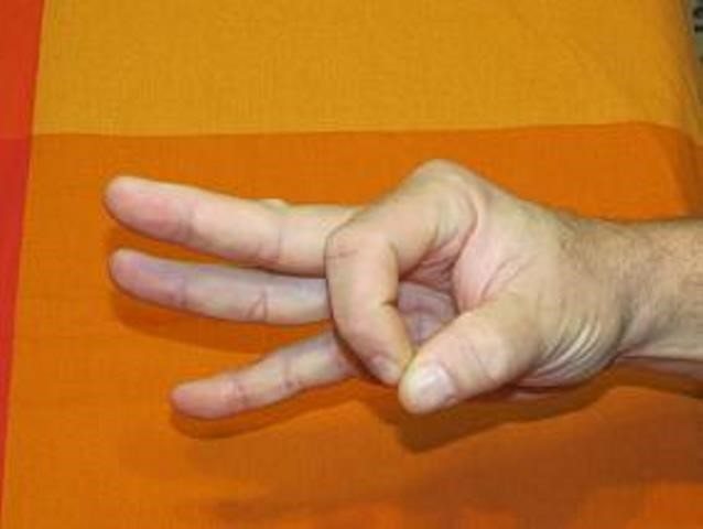 Restoring a hand after a stroke